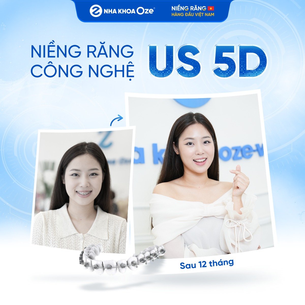 Khách hàng niềng răng