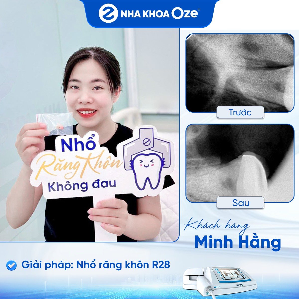 Khách hàng nhổ răng khôn