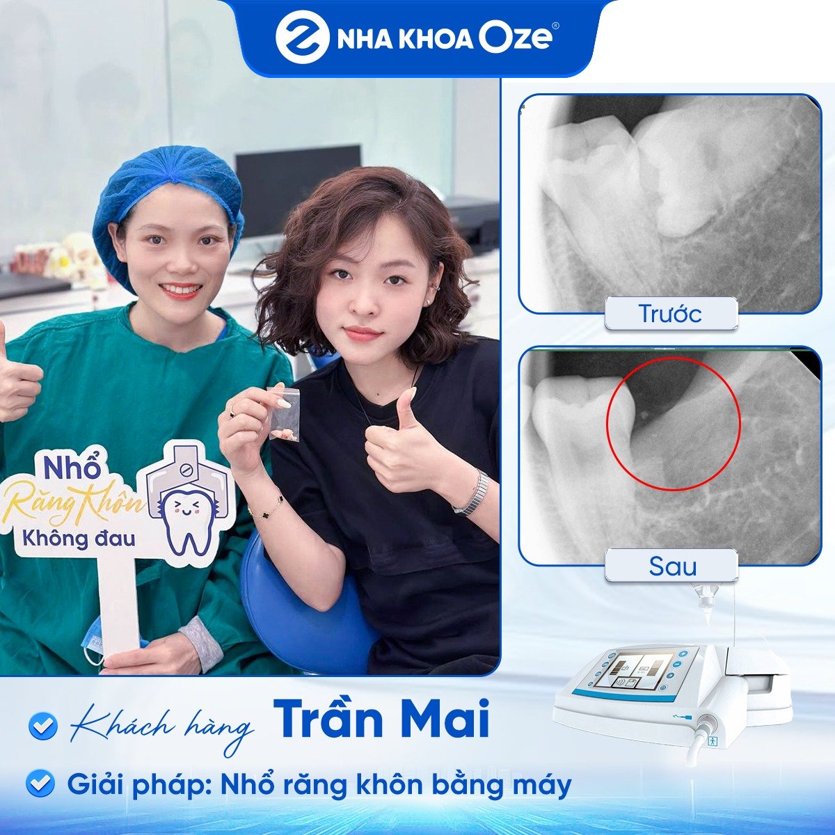 Khách hàng nhổ răng khôn