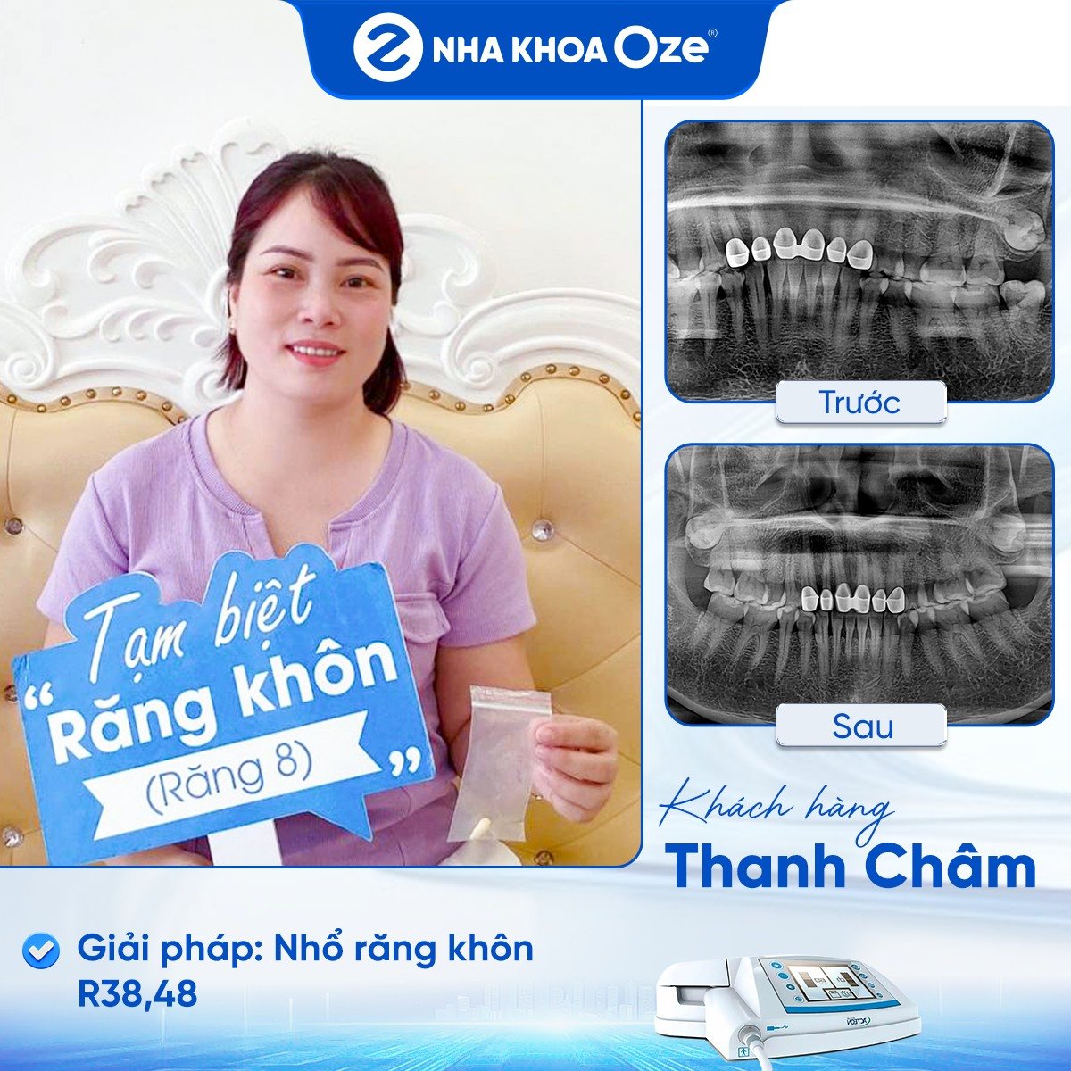 Khách hàng nhổ răng khôn
