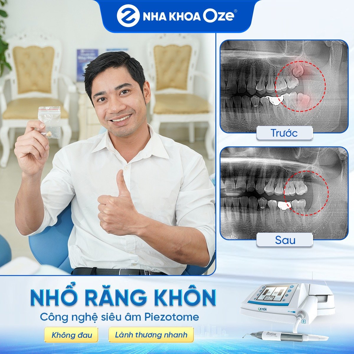 Khách hàng nhổ răng khôn