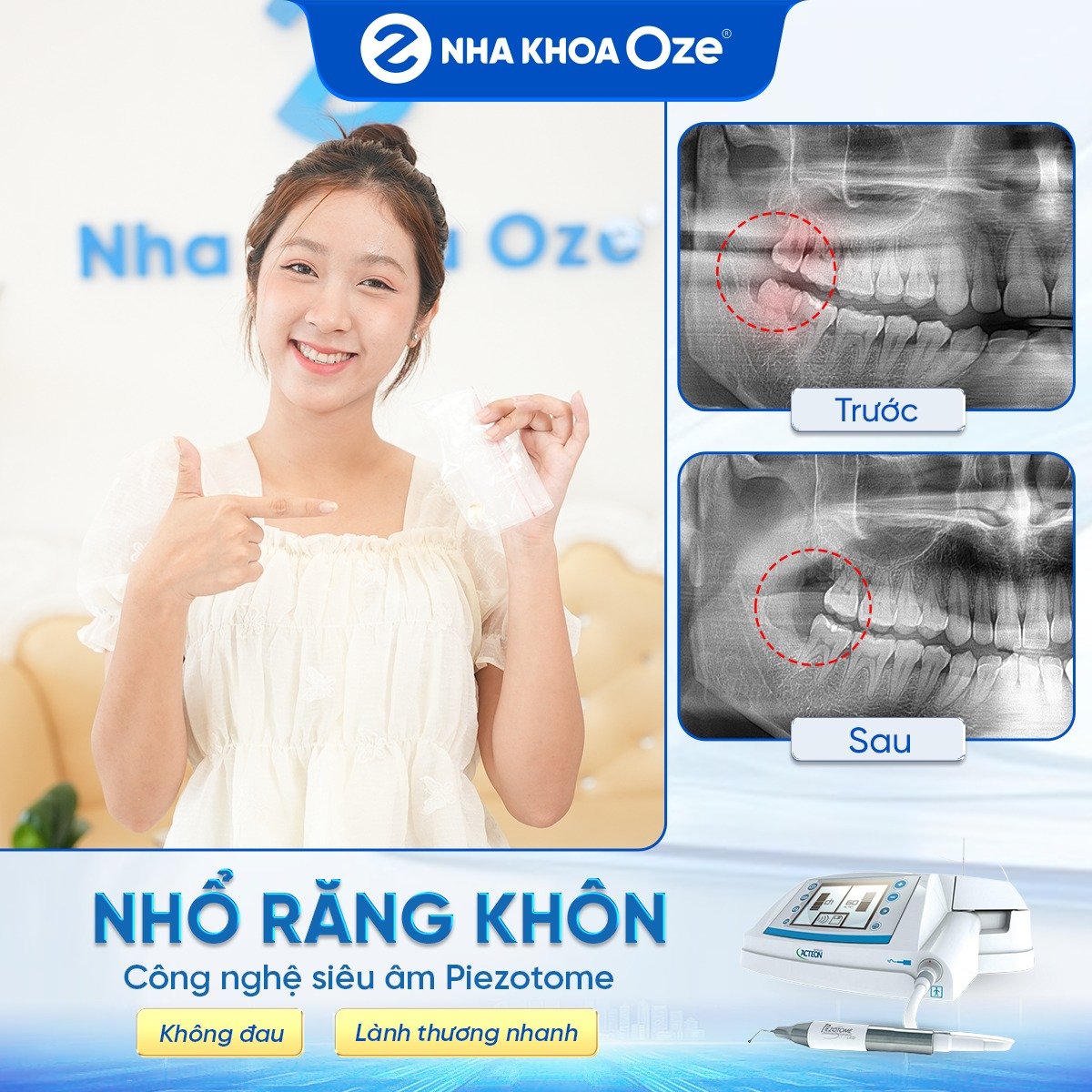 Khách hàng nhổ răng khôn