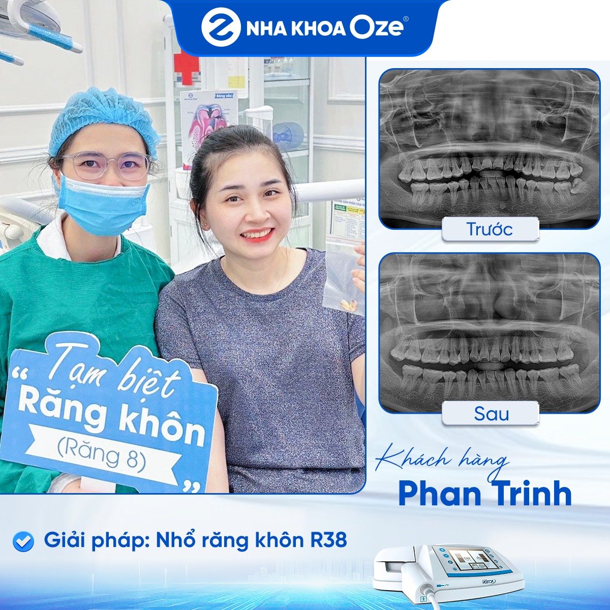 Khách hàng nhổ răng khôn