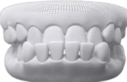 Răng móm