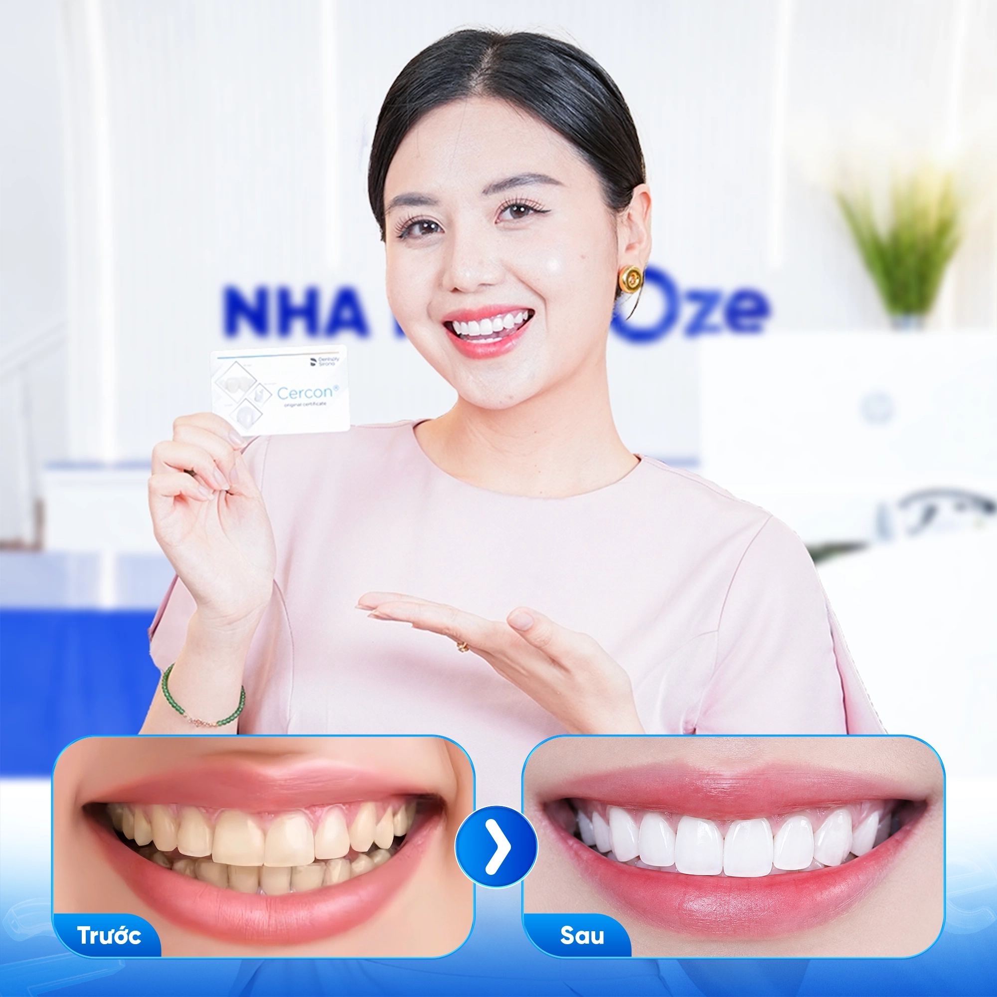 Khách hàng bọc răng sứ