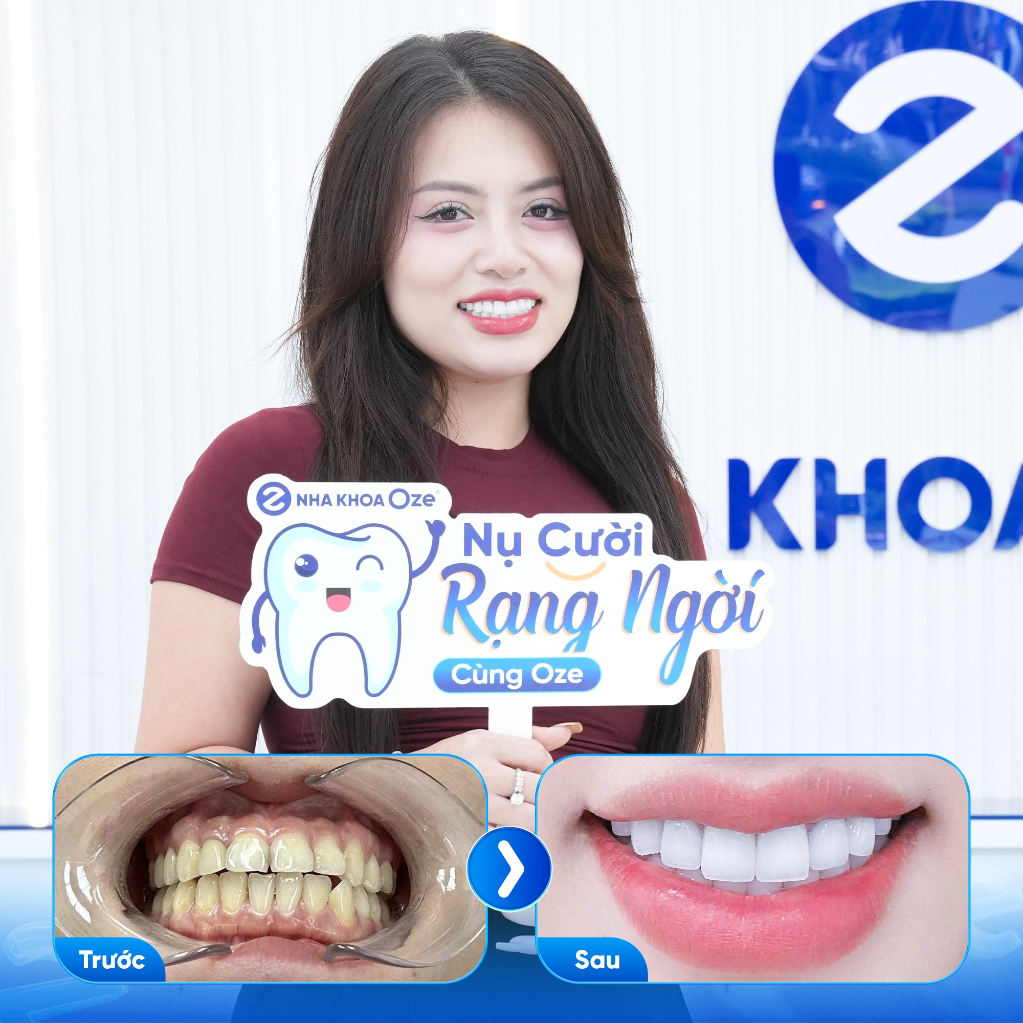 Khách hàng bọc răng sứ