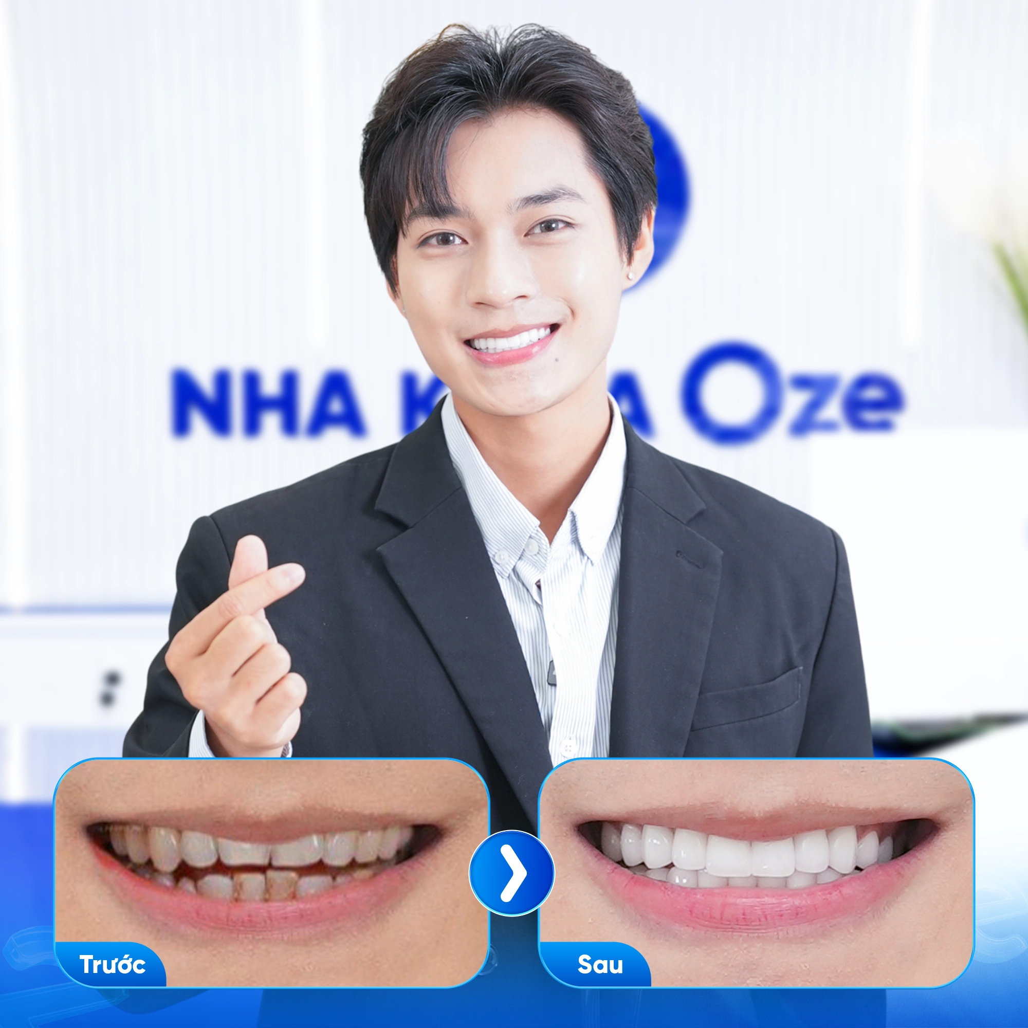 Khách hàng bọc răng sứ