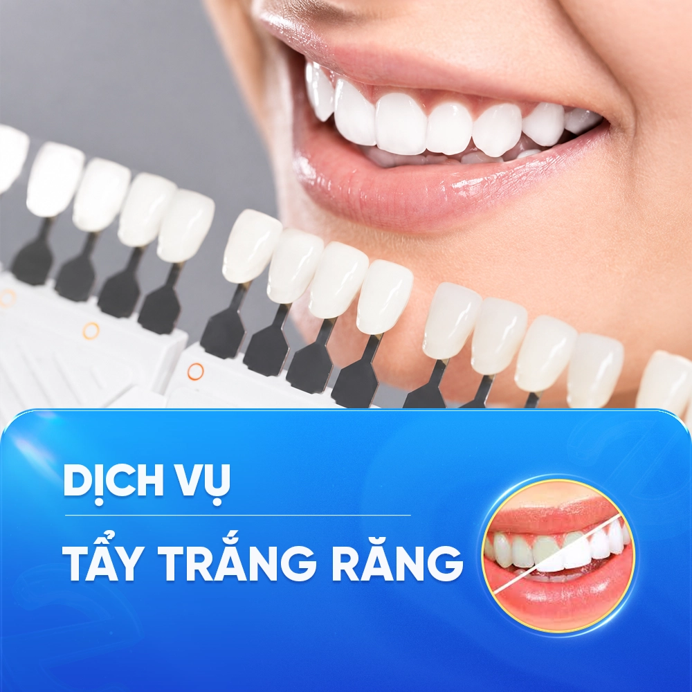 TẨY TRẮNG RĂNG